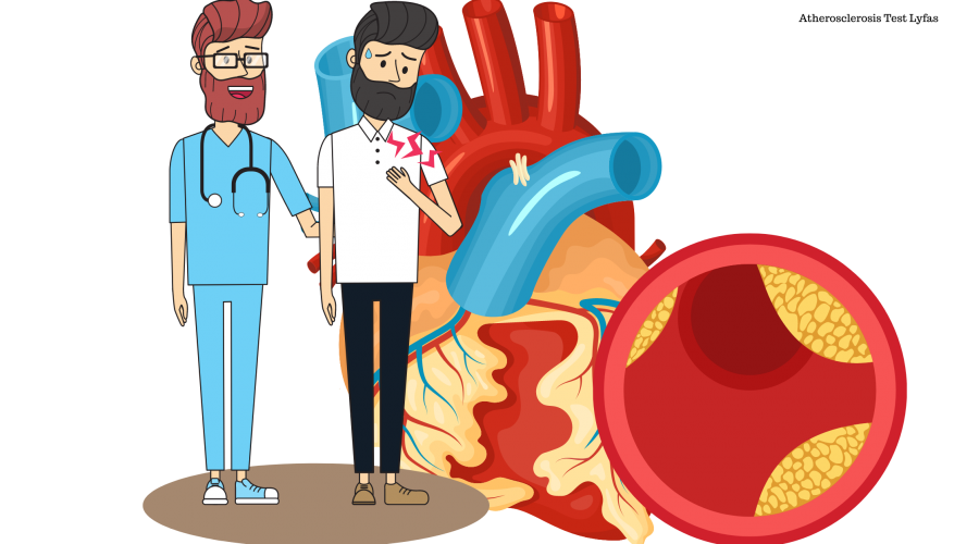 Atherosclerosis Diagnosis Lyfas Arterial Stiffness