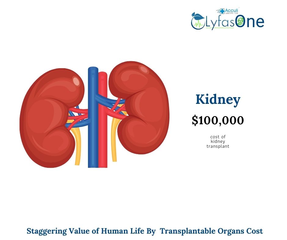 How Much Does an Organ Transplant Cost Makes Human Life Insanely High ...
