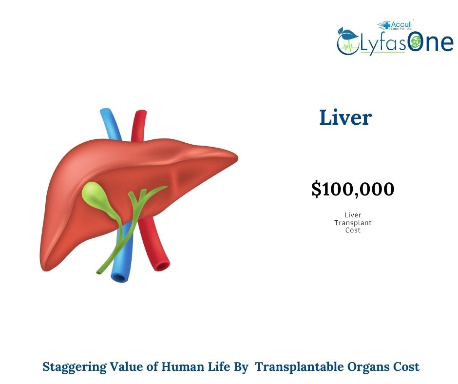 How Much Does an Organ Transplant Cost Makes Human Life Insanely High Value Lyfas Life Care