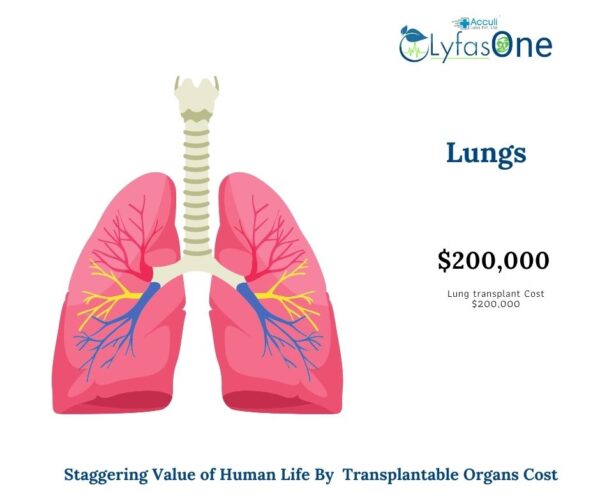 How Much Does an Organ Transplant Cost Makes Human Life Insanely High
